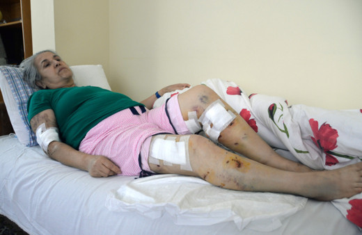 Mersin'de yürüyüş yaparken sokakta kabusu yaşadı: Ensemden ısırdılar