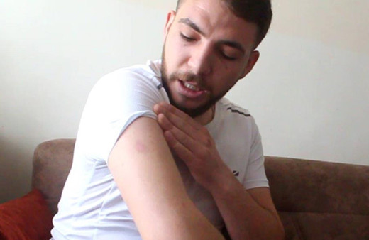 Sivas'ta uyuduğu sırada başına geldi şoku atlatamadı! Sabah 8'de...