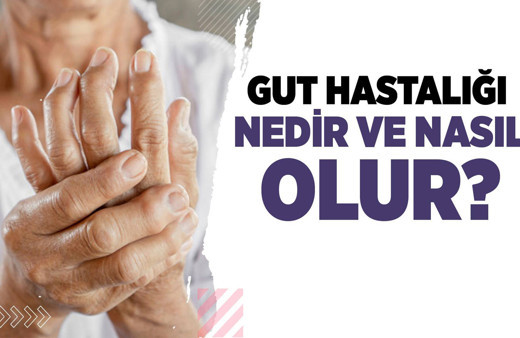 Gut hastalığı nedir ve nasıl olur?