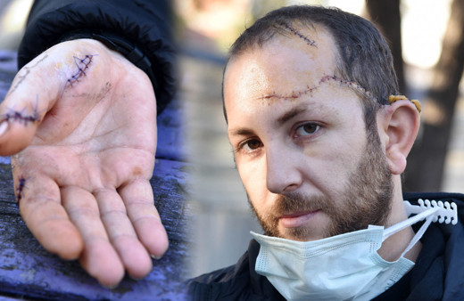 Antalya'da her şey rüyasını anlatmasıyla başladı: Kayınpederim duygusal davrandı