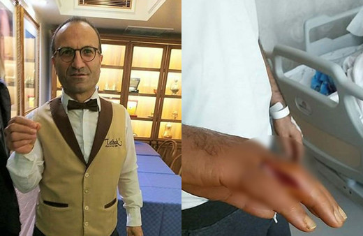 Doktorlar bile şok oldu! Eline kürdan batan adam ölümden döndü