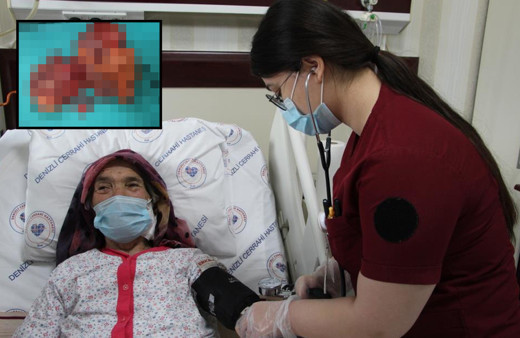 Denizli'de karın ağrısıyla gitti gerçeği öğrenince şok oldu! Karnından dışarı sarkmış...