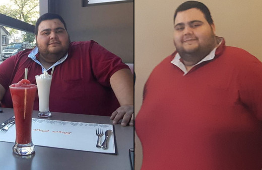 279 kiloydu nefes alamıyordu! Ankaralı gencin son halini gören inanamadı