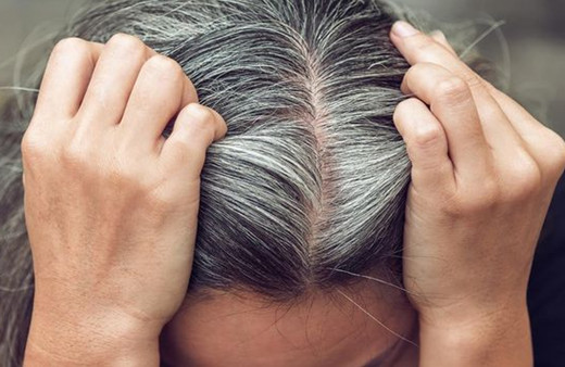 Genç yaşta saçlar neden beyazlar B12 vitamini eksikliğiniz varsa...