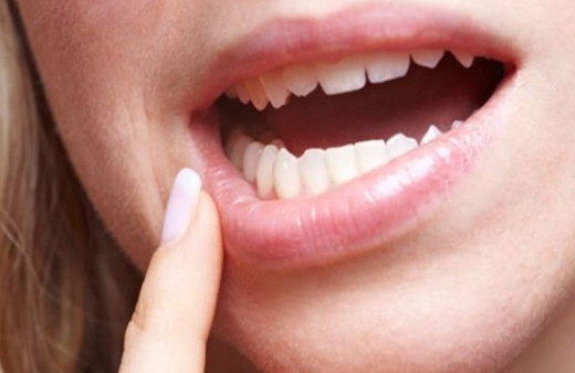 Aft neden olur stres ve depresyon aft oluşumunda etken!