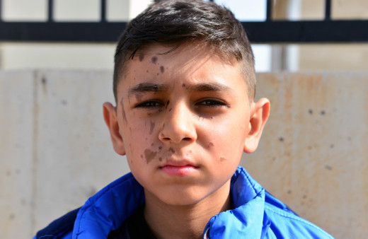 Adana'da oyun oynarken arkadaşı bu hale getirdi! Kıyafetleri bile delik deşik