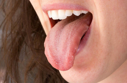 Ağız kuruluğunu ihmal etmeyin