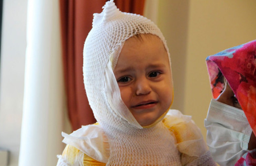 Kaynar süt faciası! Yusuf bebeğin tüm vücudu yandı