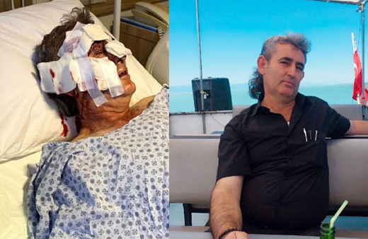 Kafesinden kaçan maymun, otel personelini yüzünden yaraladı