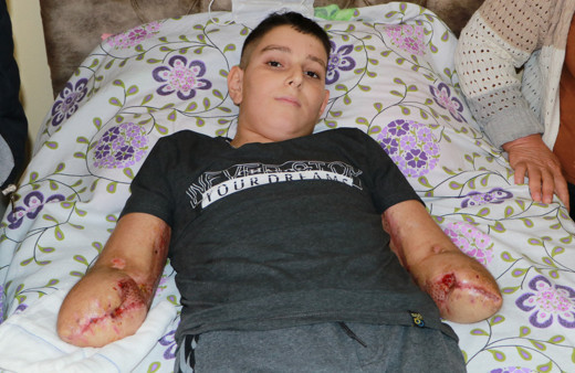 Uçurtma hayatını kararttı! Adana'da 14 yaşındaki çocuğun 1 milyon 60 bin TL'ye ihtiyacı var