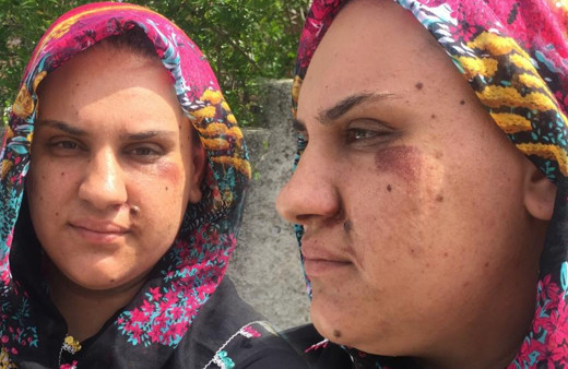 Adana'da 'bu bir canilik' deyip sokakta yaşadığı dehşeti anlattı: Görünce şüphelendim