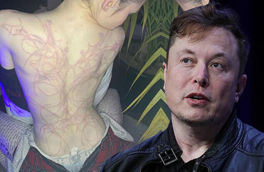 'Çok acıdı' deyip anlattı! Elon Musk'un sevgilisi Grimes'in sırtını bu halde gören şok oldu