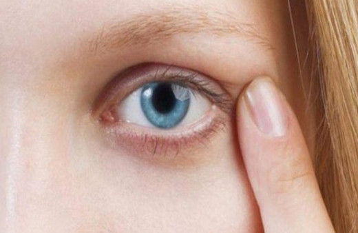 Gözüm seğiriyor neden olabilir işte göz seğirmesinin sebebi!