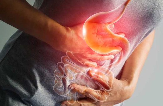 Mide yanması neden olur evde ne iyi gelir?