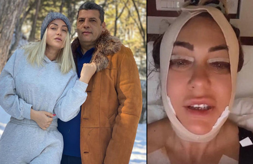 'Para veriyorsun, acı çekiyorsun' deyip paylaştı! Yeliz Yeşilmen'i gören tanıyamadı