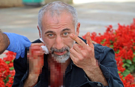 Antalya'da neşterle bir anda boğazını kesti! Sebebi ise şok etti: Kanallara çıkayım da...