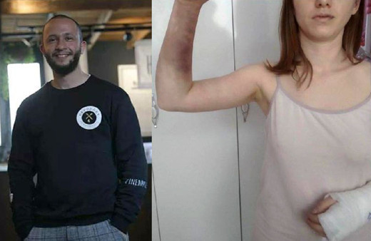 Zeynep'i beyzbol sopasıyla döven sevgilisi için istenen hapis cezası belli oldu