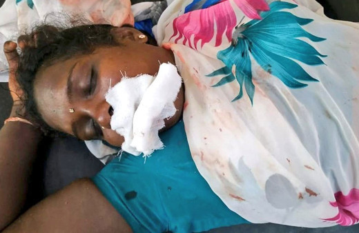 Hindistan'da bir kadın desteklediği parti seçimleri kazanınca dilini kesti