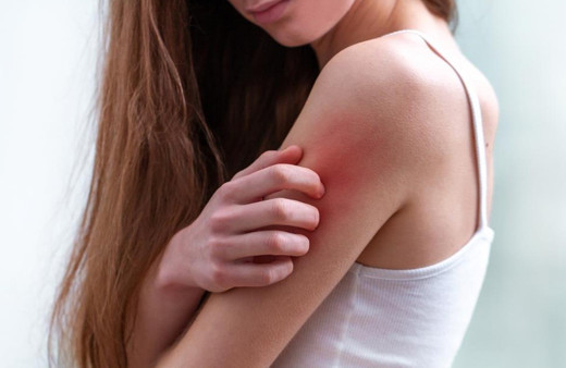 Baharda sık görülen 5 cilt hastalığı! Cildinizde kaşıntı ve kızarıklık varsa...