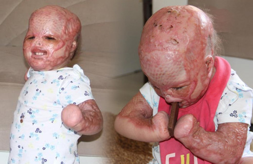 'Yüzde 90 yaşamaz' denildi! Mersin'de 2 yaşındaki bebek doktorları bile şok etti