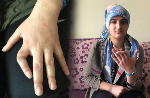 Bayburt'ta teli çekerken kopardılar hayatı kabusa döndü! 20 bin TL gerekiyor