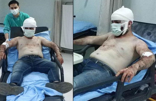 Samsun'da sosyal medyadan tanıştı! Genç kızın evinde dehşeti yaşadı: Canını zor kurtardı