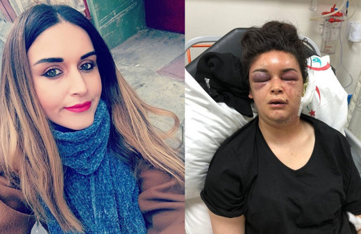 Boşanmak isteyince eşi ve ailesi işkence etti! Ailece işkence cezasız kalmadı