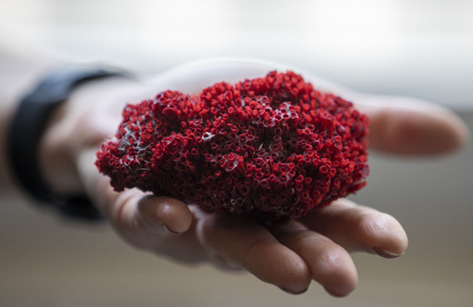 Panik atak için kardeş kanı içti entübe edildi