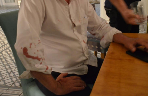 Didim Belediye Başkanı Ahmet Deniz Atabay'a beyzbol sopalı saldırı