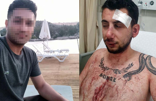 Konya'da eski sevgilisinin evini bastı karşılaştığı kişiye muştayla saldırdı