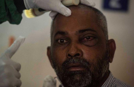 Kara Mantar kabusu şimdi de Arjantin'de! Covid19 sonrası görülüyor