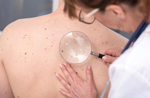 Erkeklerde cilt kanseri 10 yılda yaklaşık yüzde 50 arttı