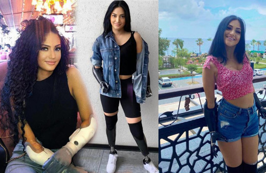 Beyza'nın hayatı 4 yıl önce altüst oldu! Almanya'dan geldi Türkiye'de nakil bekliyor