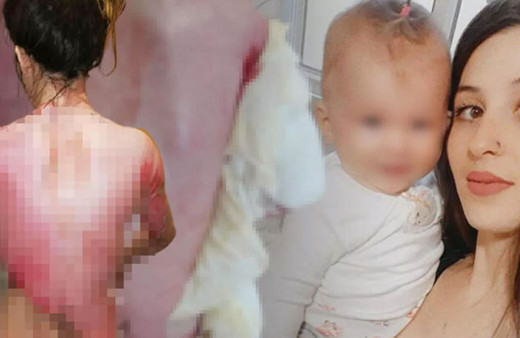 Eşi tarafından şiddet görüp, kaynar suyla yakılan kadın konuştu