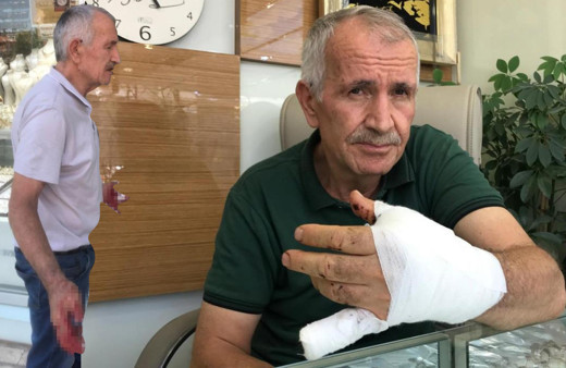 Antalya'da görünce üstüne atladı kanlar içinde kaldı: Meğer 1 gün önce...