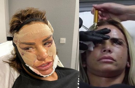 Estetiğe doymayan Katie Price Türkiye'de yine ameliyat oldu! Kocası yalvardı...