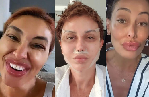 Melek Baykal'dan estetik ve dolgu dudak videosu! Serap Paköz çok kızacak!