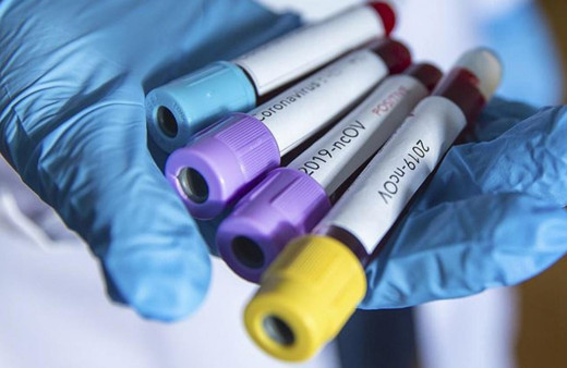 Almanya'da yeni Covid-19 testlerinde korkutucu oran: Yüzde 84'e çıktı