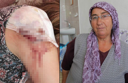 Nevşehir'de domates toplarken hayatının şokunu yaşadılar: Defalarca...