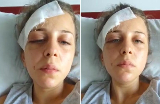 Kocaeli'de eski eşinden gördüğü işkenceyi böyle anlattı: Duvarlar kan içinde kaldı