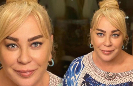 Zerrin Özer estetik mi yaptırdı inanılmaz değişim! Görenler tanıyamıyor!