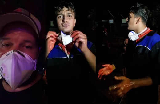 Marmaris'teki bu genç gündüz garson gece yangında! Ellerinin haline bir bakın