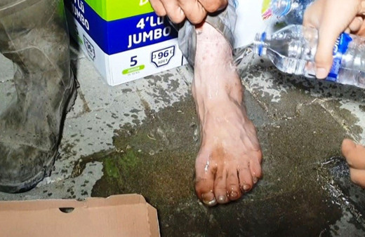 Yaralı ayağına aldırış etmeden yangından yangına koştu