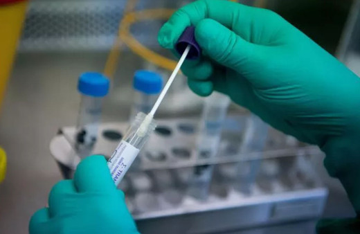Covid-19 PCR testlerinde varyant endişesi! Bilim Kurulu Üyesi Kayıpmaz açıklık getirdi