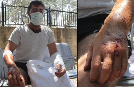 Balıkesir Kaz Dağları yangınında ayı saldırdı kabusu yaşadı: Beni altına aldı