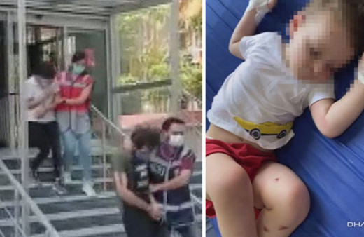 Adli Tıp sigara demişti! 2 yaşındaki çocuğuna işkence eden Suriyeli babadan akıl almaz savunma!