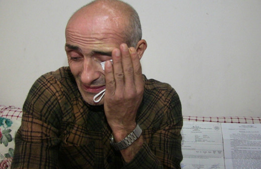 Artvin'de bel ağrısıyla gitti hayatının şokunu yaşadı: Bir anda yanmaya başladı