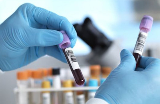 Kanser teşhisinde önemli adım! 50'den fazla kanser türünü önceden tespit edebiliyor