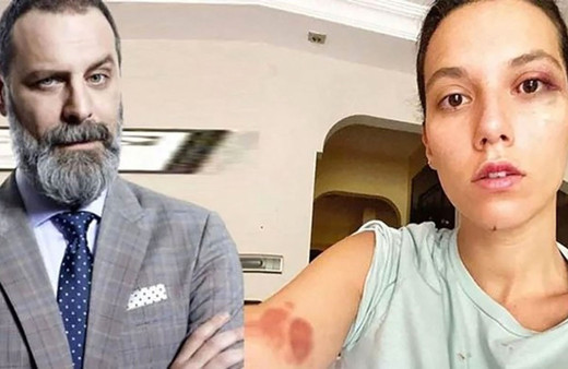 Deniz Bulutsuz'a şiddet iddiası Ozan Güven'in hayatını alt üst etti! Son hali şoke etti