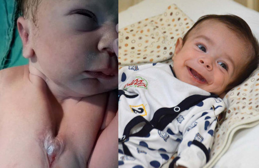 Kalbi dışarıda doğdu! Mucize bebek zor operasyonla kurtarıldı